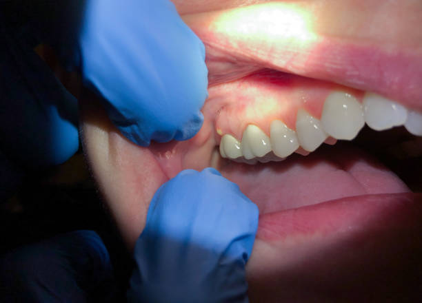  Woodfin, NC Emergency Dentist Pros