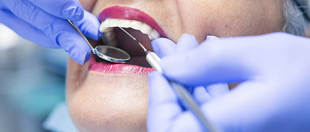Best Emergency Dentist for Lost Fillings or Crowns in Woodfin, NC