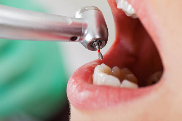 Best Orthodontic Emergency Dentist in Woodfin, NC